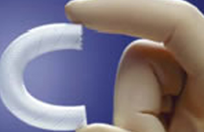 Wallgraft™ Endoprótesis