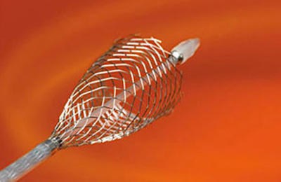 Wallstent Carotideo monorriel