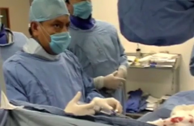 Angioplastia pie diabetico